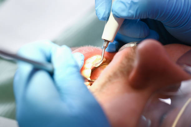 Best Emergency Dental Care for Broken or Chipped Teeth in Lake Delton, WI