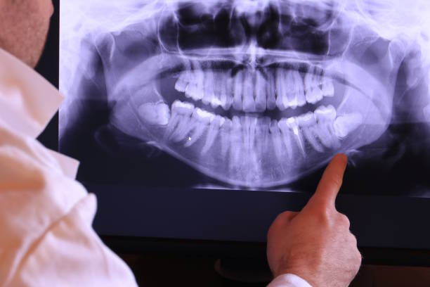 Best Emergency Gum Treatment in Lake Delton, WI