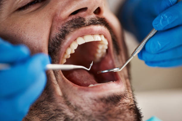 Best Emergency Treatment for Dental Infections or Abscesses in Lake Delton, WI
